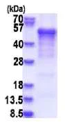 SDS-PAGE - Recombinant Human Casein Kinase 1 delta/CSNK1D protein (denatured) (His tag N-Terminus) (AB180293)