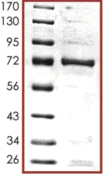 SDS-PAGE - Recombinant human Casein Kinase 1 gamma 2 protein (AB104025)