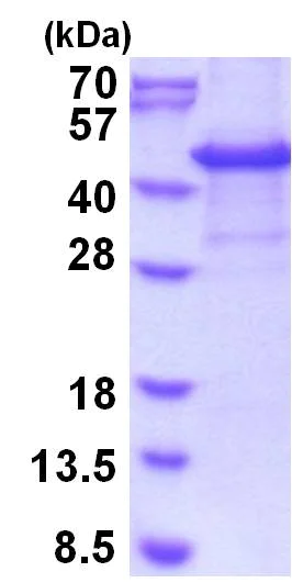 SDS-PAGE - Recombinant Human CASP protein (denatured) (His tag N-Terminus) (AB202201)