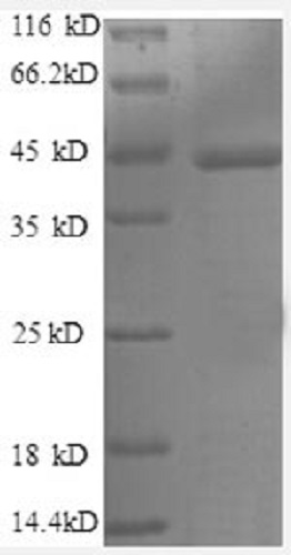 SDS-PAGE - Recombinant Human Caspase-1 protein (Tagged) (AB241237), expandable thumbnail
