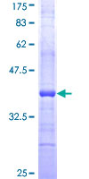 SDS-PAGE - Recombinant Human Caspase-2 protein (AB158032)