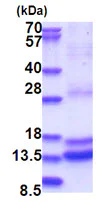 SDS-PAGE - Recombinant Human Caspase-2 protein (denatured) (AB180342)