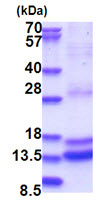 SDS-PAGE - Recombinant Human Caspase-2 protein (denatured) (His tag N-Terminus) (AB180342)