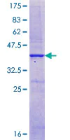 SDS-PAGE - Recombinant Human CaSR protein (AB114274)