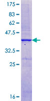 SDS-PAGE - Recombinant Human CaSR protein (GST tag N-Terminus) (AB114274)