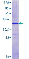 SDS-PAGE - Recombinant Human CaSR protein (GST tag N-Terminus) (AB114274)