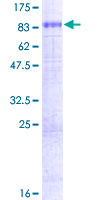 SDS-PAGE - Recombinant Human CAT1 protein (GST tag N-Terminus) (AB152687)