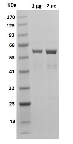 SDS-PAGE - Recombinant human Catalase protein (Active) (AB286037), expandable thumbnail
