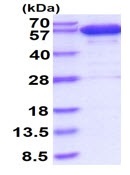 SDS-PAGE - Recombinant human Catalase protein (His tag N-Terminus) (AB130029)