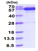 SDS-PAGE - Recombinant human Catalase protein (His tag N-Terminus) (AB130029)