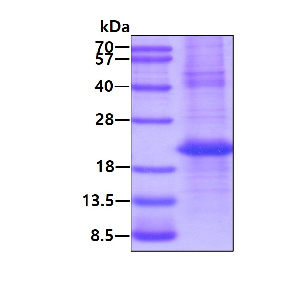 SDS-PAGE - Recombinant Human Cathelicidin/CLP protein (denatured) (AB140725)