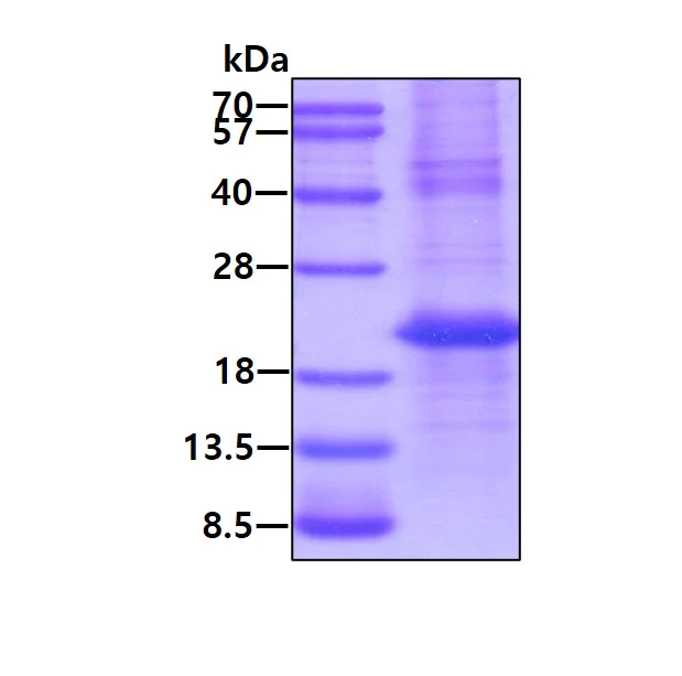 SDS-PAGE - Recombinant Human Cathelicidin/CLP protein (denatured) (His tag N-Terminus) (AB140725)