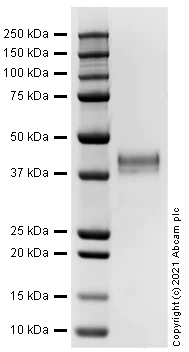 SDS-PAGE - Recombinant Human Cathepsin B protein (Active) (AB283434)