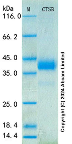 SDS-PAGE - Recombinant Human Cathepsin B Protein Standard (His tag) (AB316417)
