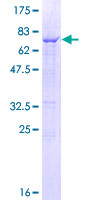SDS-PAGE - Recombinant Human Cathepsin C protein (AB158099), expandable thumbnail