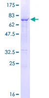 SDS-PAGE - Recombinant Human Cathepsin C protein (AB158099)