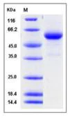 SDS-PAGE - Recombinant Human Cathepsin C protein (His tag) (AB276277)