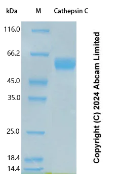 SDS-PAGE - Recombinant Human Cathepsin C Protein Standard (His tag) (AB323128)