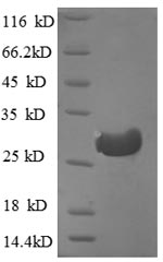 SDS-PAGE - Recombinant Human Cathepsin F protein (His tag) (AB240858)