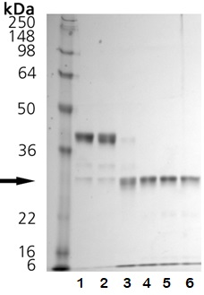 Functional Studies - Recombinant human Cathepsin K protein (Active) (AB157067)
