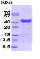 SDS-PAGE - Recombinant Human Cathepsin L/MEP protein (His tag) (AB222993), expandable thumbnail