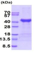 SDS-PAGE - Recombinant Human Cathepsin L/MEP protein (His tag) (AB222993)