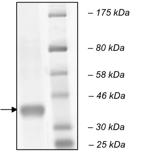 SDS-PAGE - Recombinant human Cathepsin L/MEP protein (His tag C-Terminus) (AB198444)