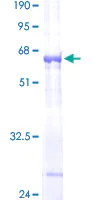SDS-PAGE - Recombinant Human Cathepsin O protein (AB158237)