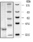Recombinant human Cathepsin S protein (His tag)