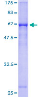 SDS-PAGE - Recombinant Human Cathepsin W protein (AB158238), expandable thumbnail