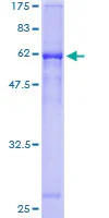 SDS-PAGE - Recombinant Human Cathepsin W protein (GST tag N-Terminus) (AB158238)