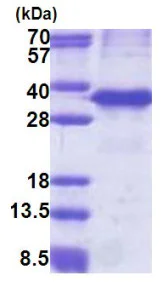 SDS-PAGE - Recombinant Human Cathepsin Z protein (denatured) (His tag N-Terminus) (AB171674)