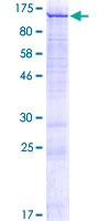 Recombinant Human CATSPER1 protein