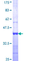 Recombinant Human CATSPER3 protein