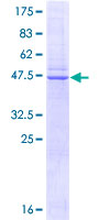 Recombinant Human Caveolin-1 protein