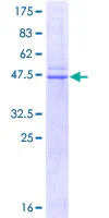 SDS-PAGE - Recombinant Human Caveolin-1 protein (GST tag N-Terminus) (AB114170)