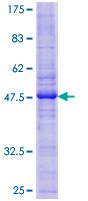 Recombinant Human Caveolin-2 protein