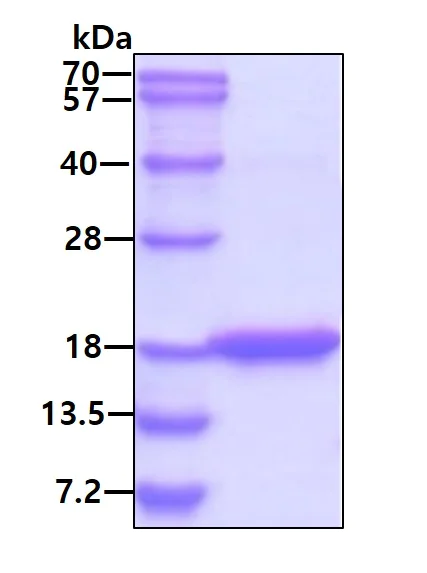 SDS-PAGE - Recombinant Human CBF protein (AB86217)