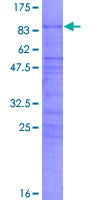 SDS-PAGE - Recombinant Human CBF1 interacting corepressor/CIR1 protein (AB160540)