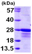 SDS-PAGE - Recombinant Human CBFb protein (AB98252), expandable thumbnail