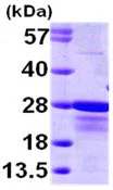 SDS-PAGE - Recombinant Human CBFb protein (AB98252)