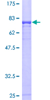 Recombinant Human Cbl-c protein