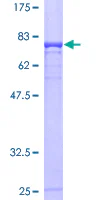 SDS-PAGE - Recombinant Human Cbl-c protein (GST tag N-Terminus) (AB161722)
