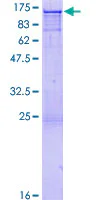 SDS-PAGE - Recombinant Human CBL protein (GST tag N-Terminus) (AB114527)