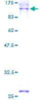 SDS-PAGE - Recombinant Human CBP80 protein (AB114735), expandable thumbnail