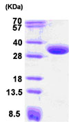 SDS-PAGE - Recombinant Human CBR1 protein (AB85336)