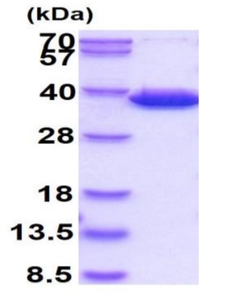 SDS-PAGE - Recombinant Human CBR3 protein (AB86848)