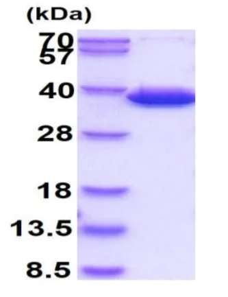 SDS-PAGE - Recombinant Human CBR3 protein (His tag N-Terminus) (AB86848)