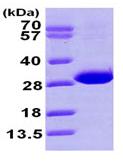 Recombinant Human CBR4 protein