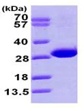 SDS-PAGE - Recombinant Human CBR4 protein (His tag N-Terminus) (AB101110)